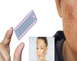 اثرات قرص های ضدبارداری بر پوست