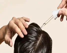 همه چیز درباره ماینوکسیدیل برای ریزش و رشد مو